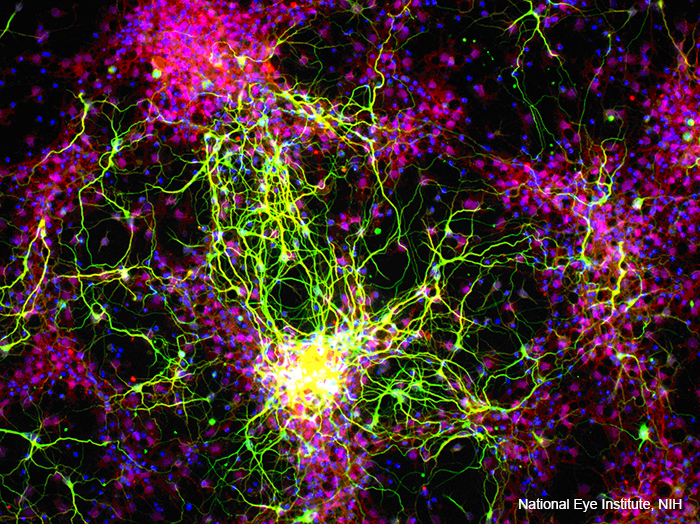 reinal ganglion cells